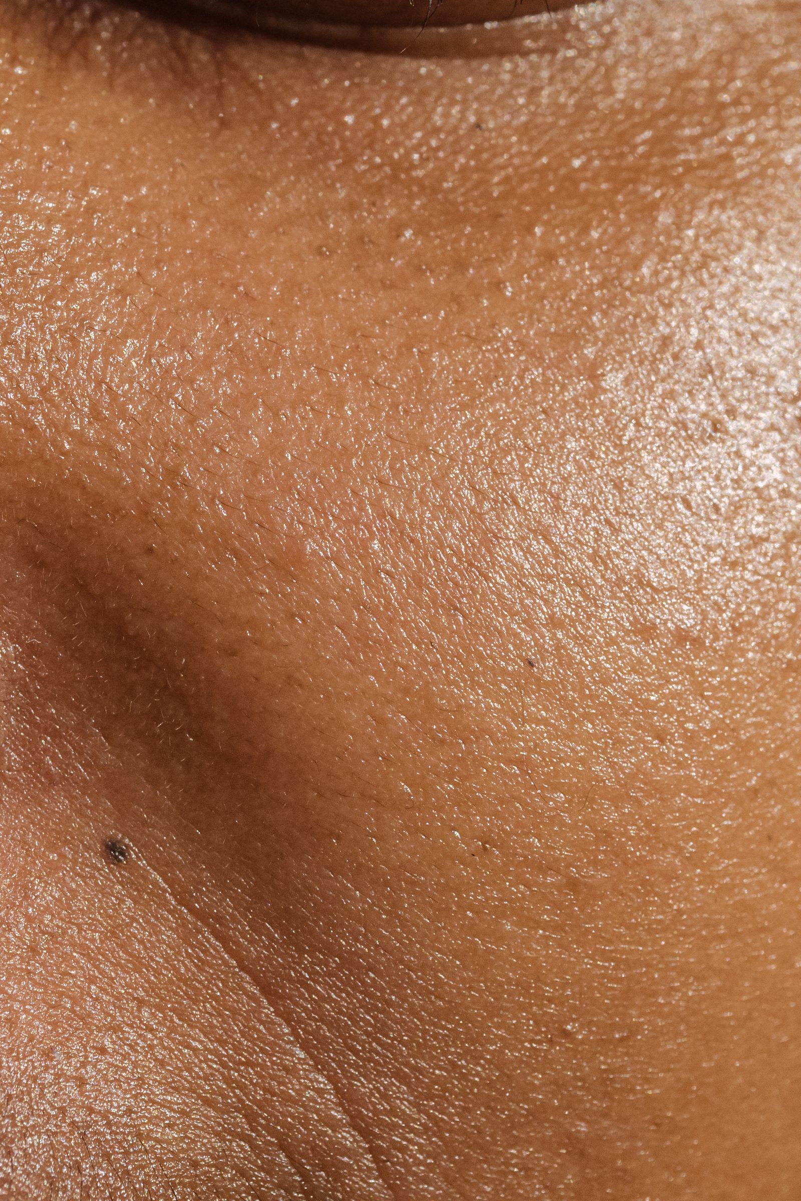 Close detail of skin tone and pigmentation
