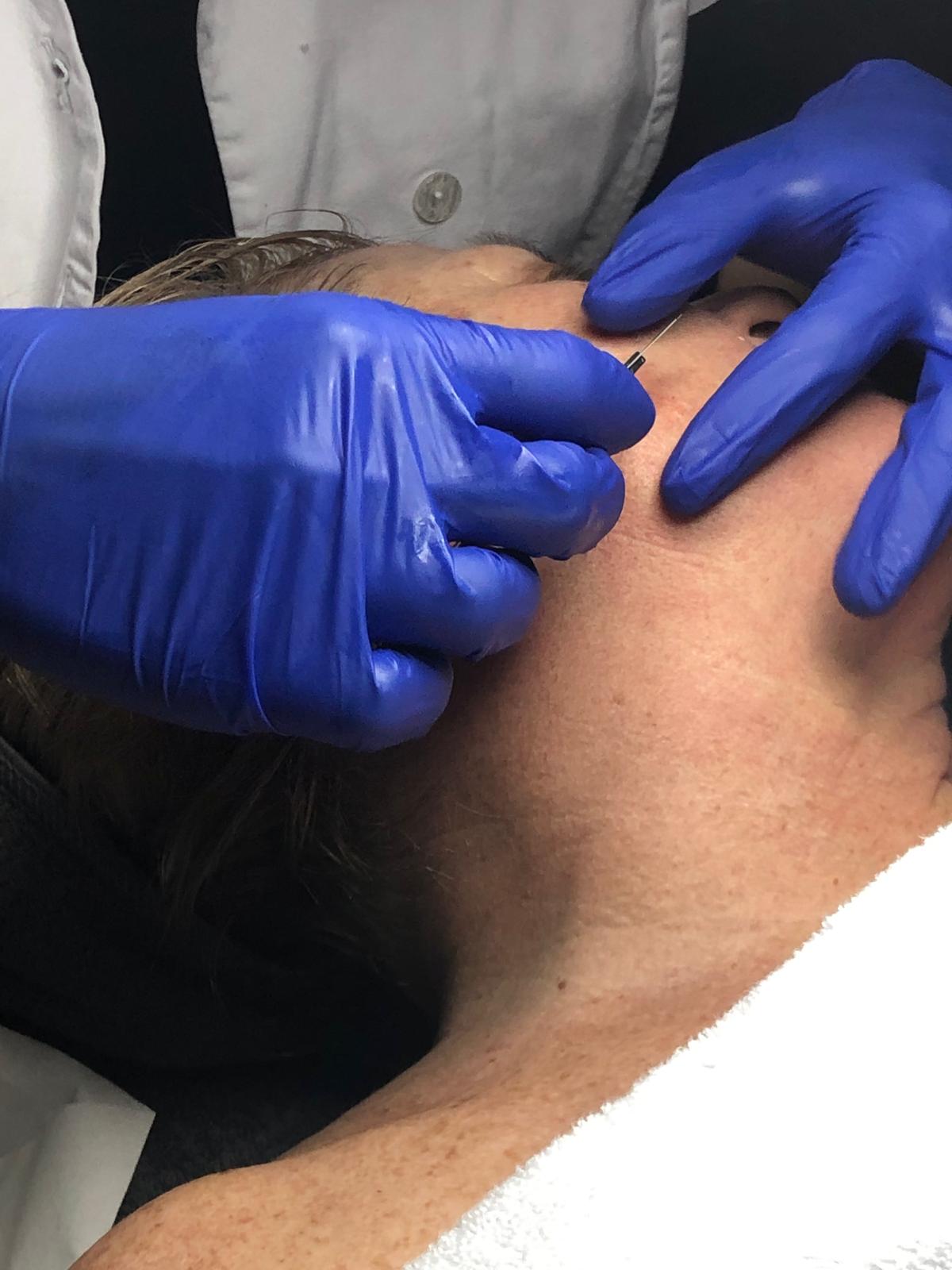 Skin assessed closely before any treatment is chosen