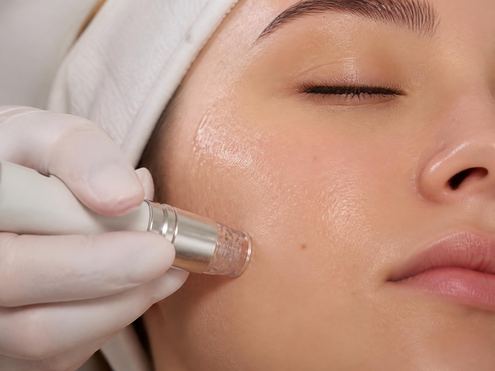 Hydrodermabrasion treatment restoring hydration and clarity