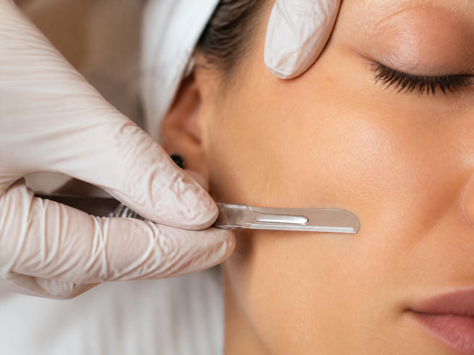 Precision dermaplaning treatment on a client's cheek